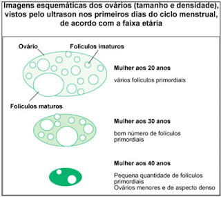 Exame de transvaginal